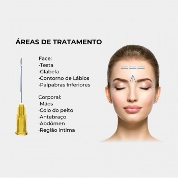 FIOS PDO VOLUME MONO EYE 30G 38MM 50MM AG MG C/10 PRODEEP ALUR MEDICAL