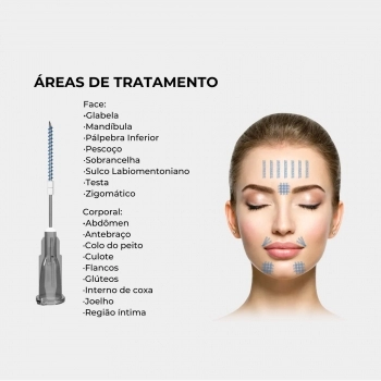 FIOS PDO SCREW 27G 38MM 50MM AG MG C/10 PRODEEP ALUR MEDICAL